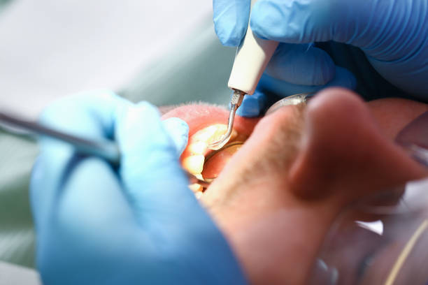 Best Emergency Dental Care for Broken or Chipped Teeth in Wortham, TX
