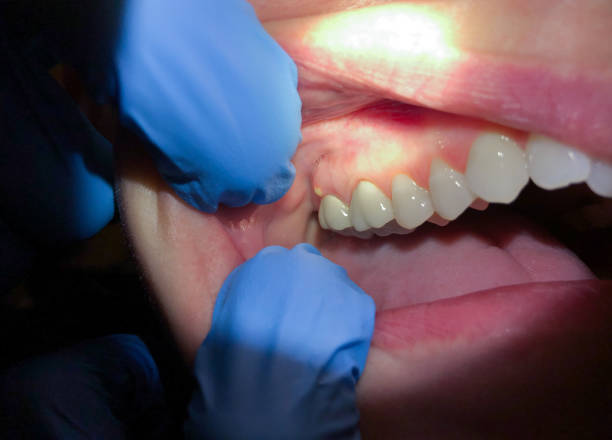 Best Urgent Care for Lost Fillings or Crowns in Wortham, TX
