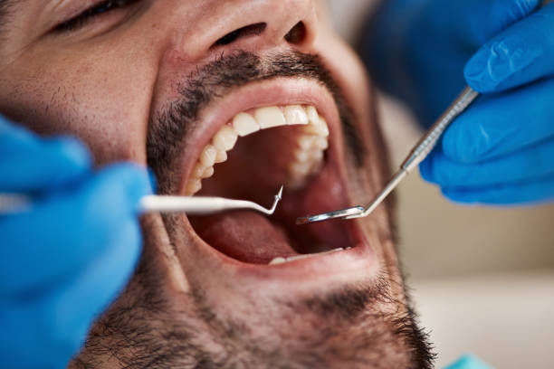 Best Same-Day Emergency Dental Services in Wortham, TX